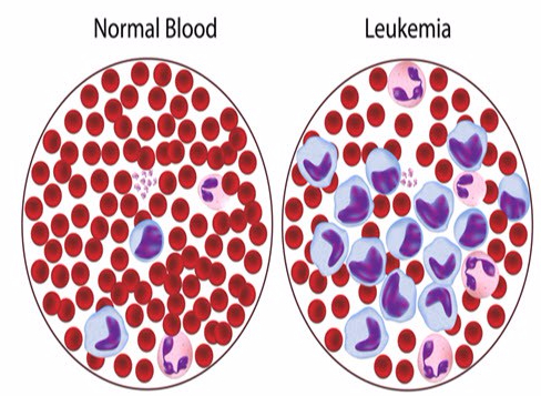Leukemia-Blood-Cells-PowerPoint-Template-Slide-1